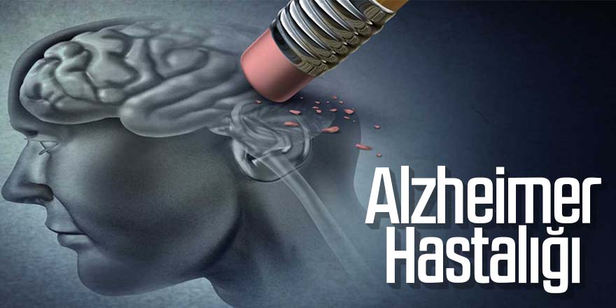 alzheimer-hastaligi-ve-tedavisi.JPG